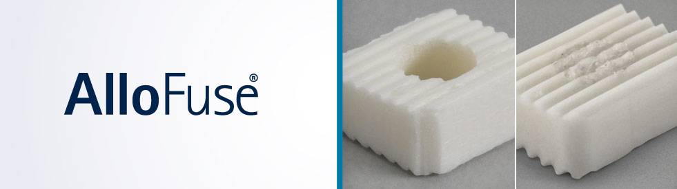 AlloFuse® Cervical Grafts