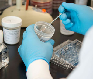Tissue Processing